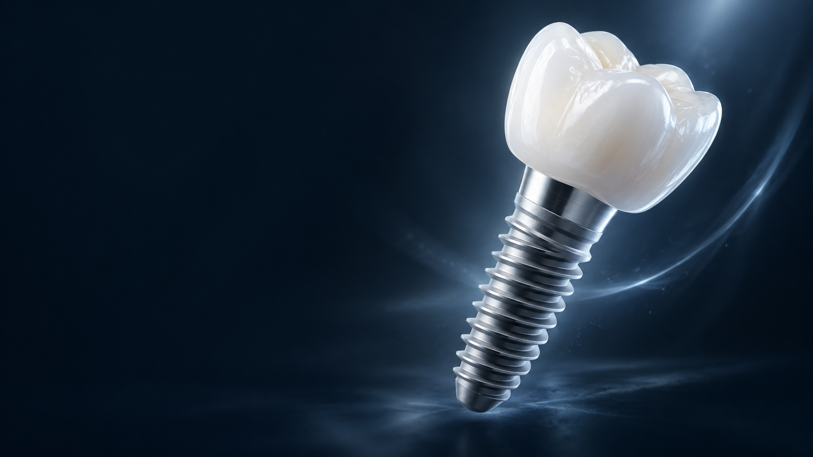 Representação artística de um implante dentário